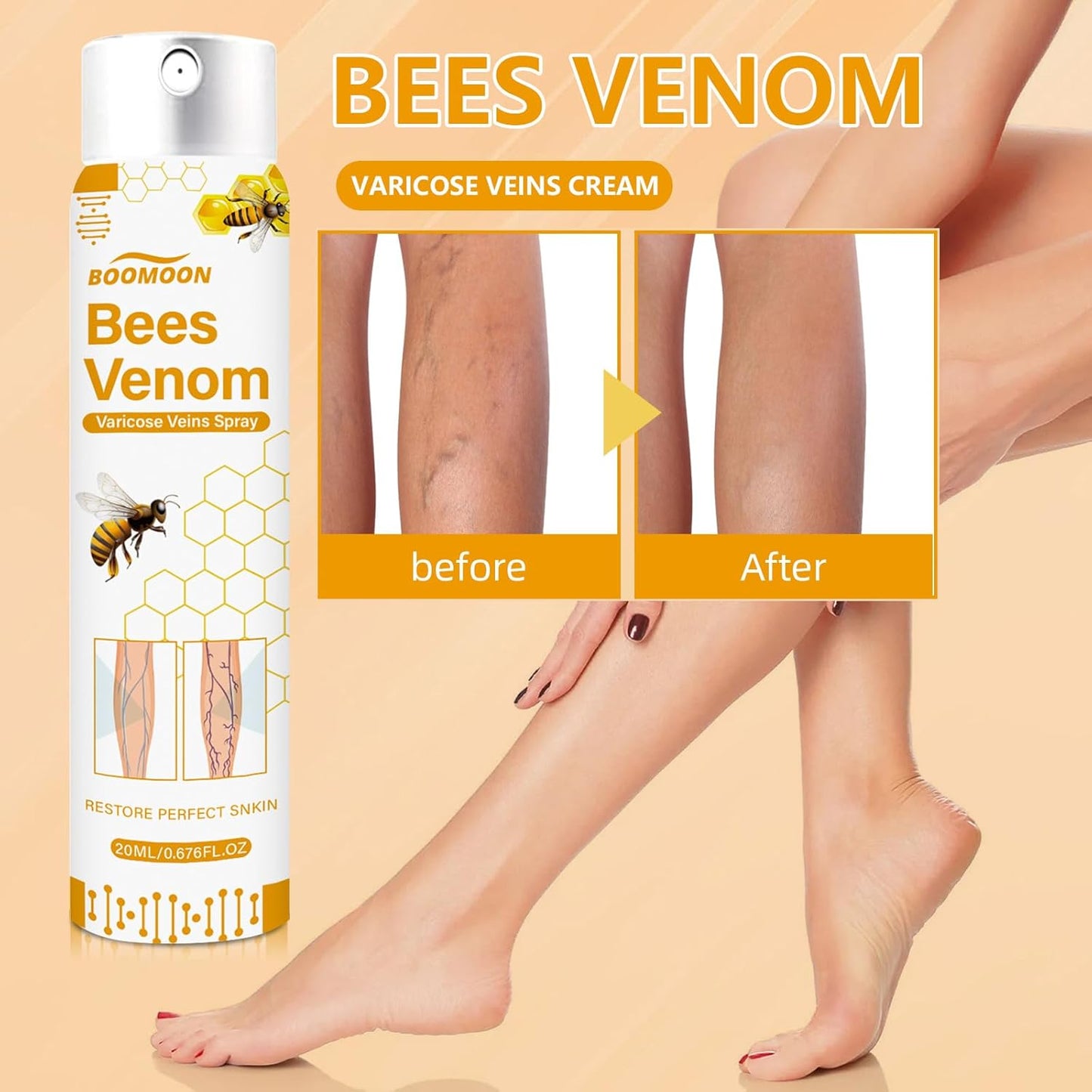 Bee Venom Varicose Veins Spray