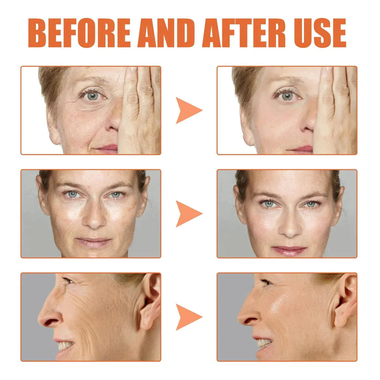 Botox Antiage Face Serum